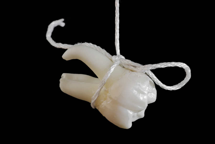 Top 10 Signs You Might Need a Tooth Extraction