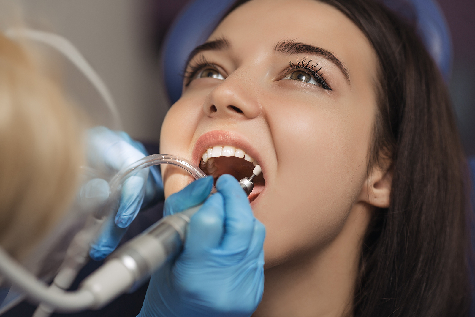 Top 5 Signs You Might Have an Abscessed Tooth